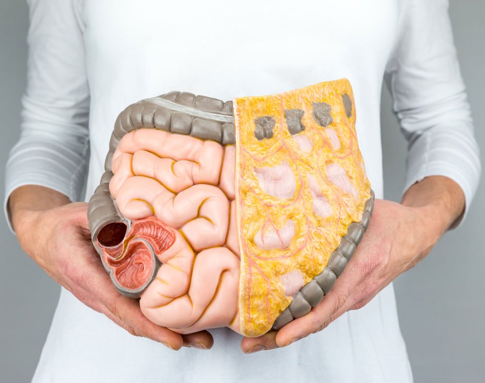 After Colon Hydrotherapy