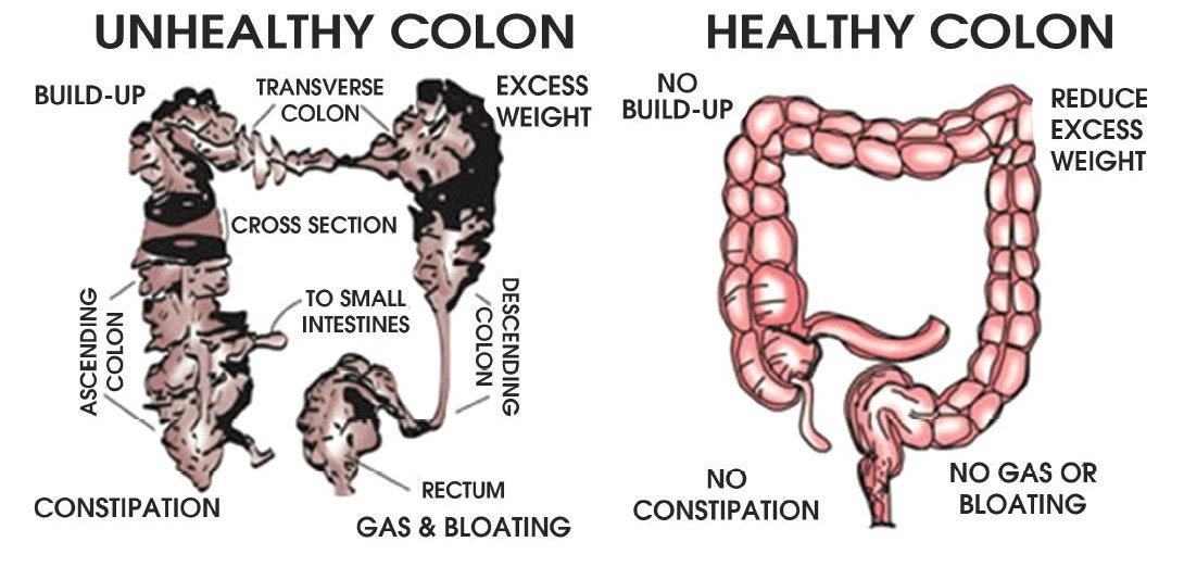 What Is the Cost of Colon Hydrotherapy?